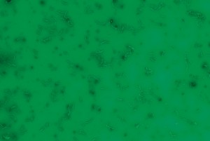 Bacteria